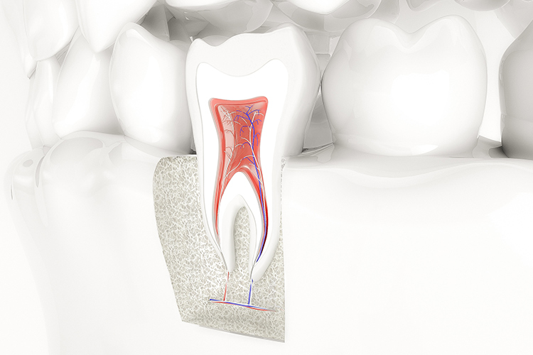 Endodontie - Wurzelkanal Behandlung - Zahnarzt in 58300 Wetter (Ruhr)